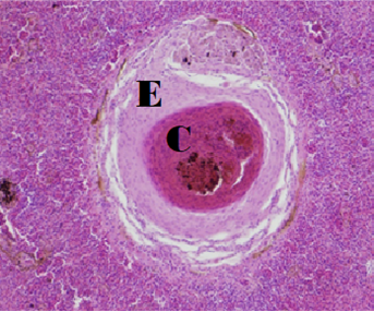 Striped Bass Mycobacteriosis Granuloma