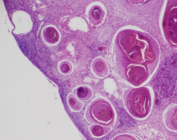 Mycobacteriosis Striped Bass